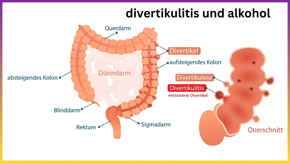 divertikulitis und alkohol